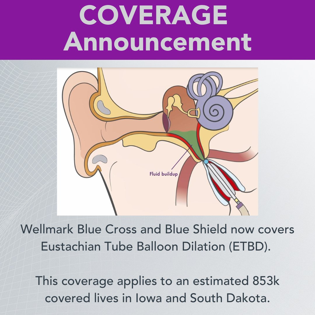 Acclarent tweet media