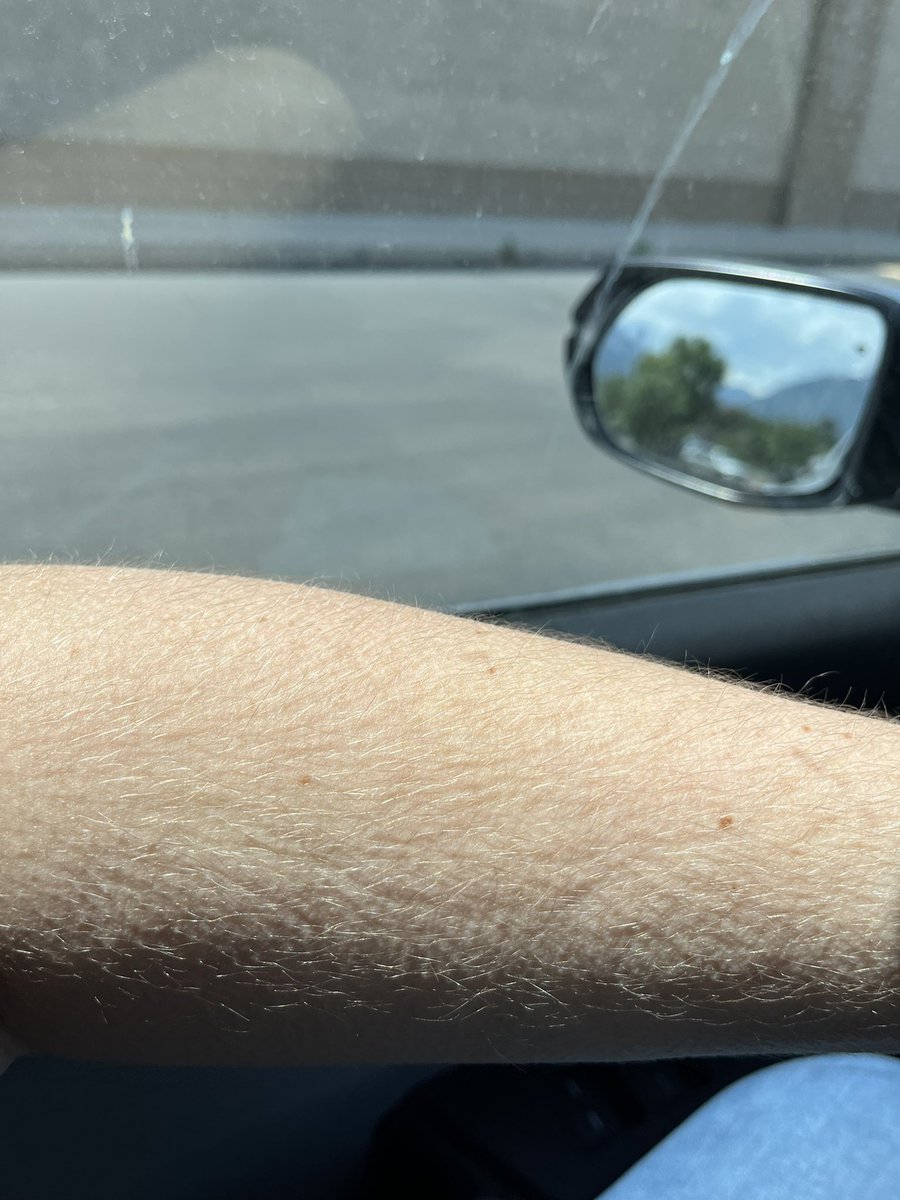 Symptom of the King of Petras’s King Of Hearts chorus.