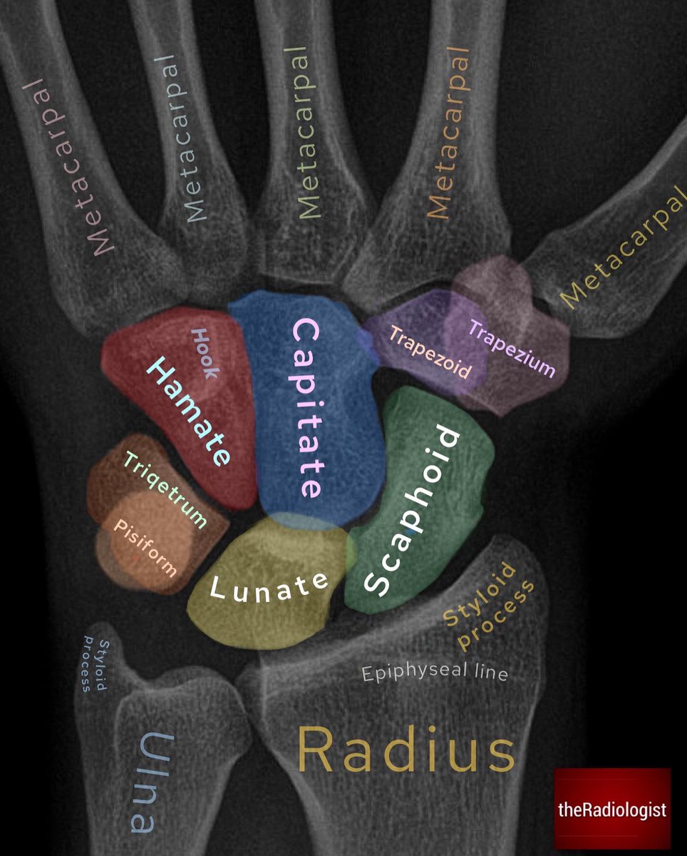 radiologistpage's tweet photo. Carpal bone anatomy https://t.co/GFFCFTTTYu