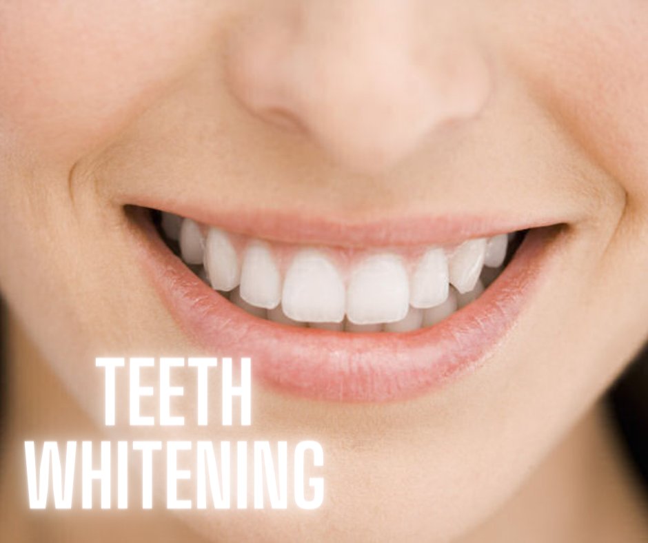 CarbamideTeeth's tweet photo. Our professional teeth whitener is the same strength as your dentist charges hundreds of dollars for #dentist https://t.co/dEIO3oYBQ5
