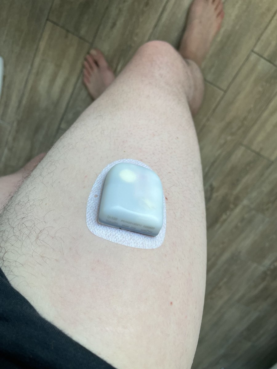 matt1DUK's tweet photo. Years of waiting (no thanks to covid) but I’m finally on a insulin pump 🙌🙌 genuinely life changing #t1d #T1D #typeonediabetes #omnipod @myomnipod https://t.co/bDq5WQyP2F
