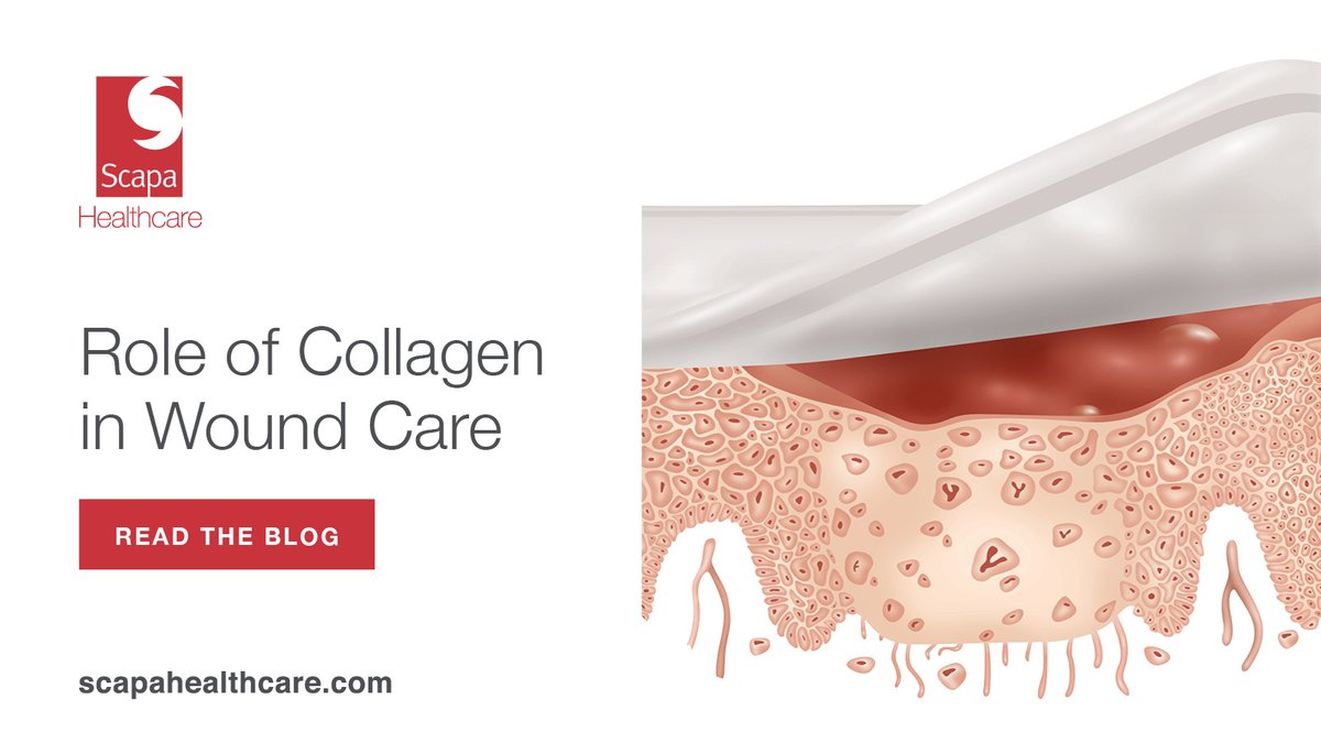 #DYK Collagen can be manufactured into many medical device constructs to suit different wound care applications. Read our blog to learn more: scapahealthcare.com/resource-libra… 

#woundcare #woundhealing #advancedwoundcare #CDMO #contractmanufacturing #woundcareawareness
