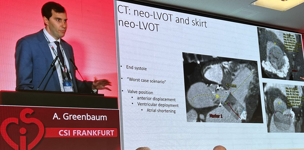 Rim Halaby (@rimhalabymd) on Twitter photo Fantastic electrosurgery session at <a href="/CSIcongress/">CSI Congress</a> #csifrankfurt with excellent discussion on transcaval, basilica, lampoon, and tips and tricks for intraprocedural imaging
<a href="/AdamGreenbaumMD/">Adam Greenbaum</a> <a href="/CathElectroSurg/">Jaffar Khan</a> <a href="/jamiemccabeMD/">Jamie McCabe</a> Fantastic electrosurgery session at <a href="/CSIcongress/">CSI Congress</a> #csifrankfurt with excellent discussion on transcaval, basilica, lampoon, and tips and tricks for intraprocedural imaging
<a href="/AdamGreenbaumMD/">Adam Greenbaum</a> <a href="/CathElectroSurg/">Jaffar Khan</a> <a href="/jamiemccabeMD/">Jamie McCabe</a>