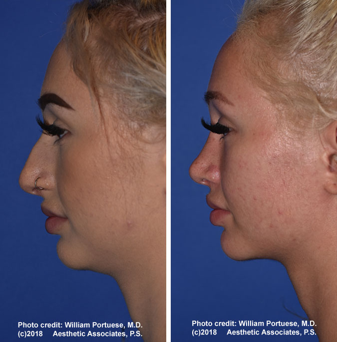 The Portland Center for Facial Plastic Surgery tweet media
