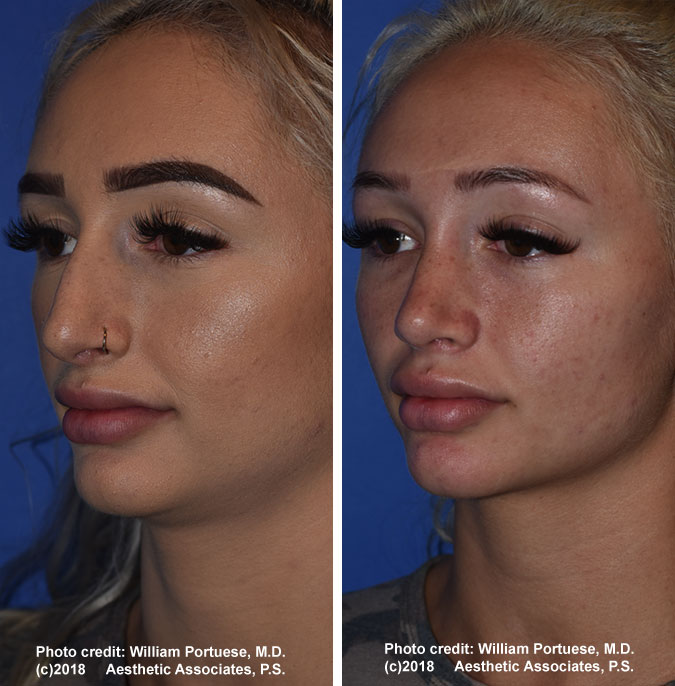 The Portland Center for Facial Plastic Surgery tweet media