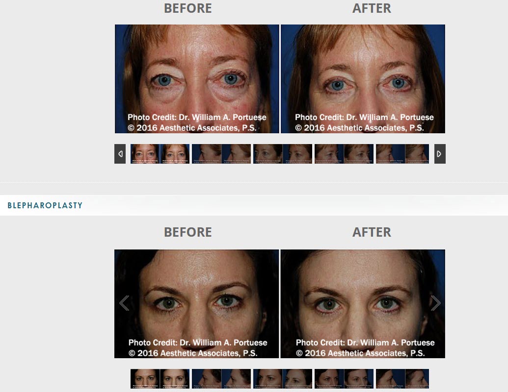The Portland Center for Facial Plastic Surgery tweet media