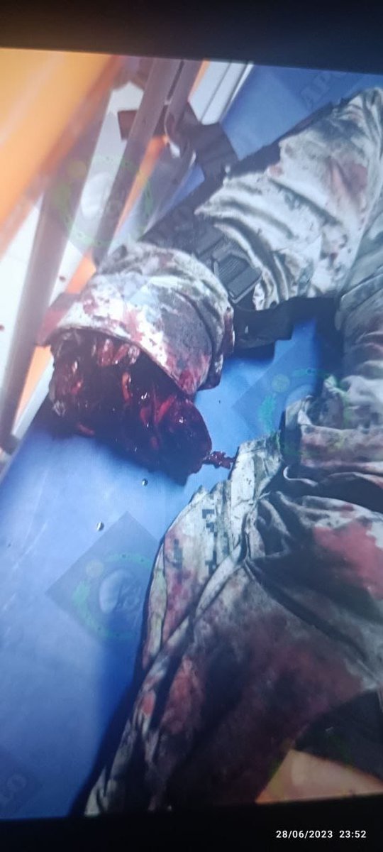 blanmirelesfire's tweet photo. #Celaya #CocheBomba actualización dos elementos de la Guardia Nacional heridos graves, uno con amputación de brazo derecho y otro con quemaduras y daños en tímpanos, 8 solo tenían heridas leves https://t.co/TH98l9GeFx