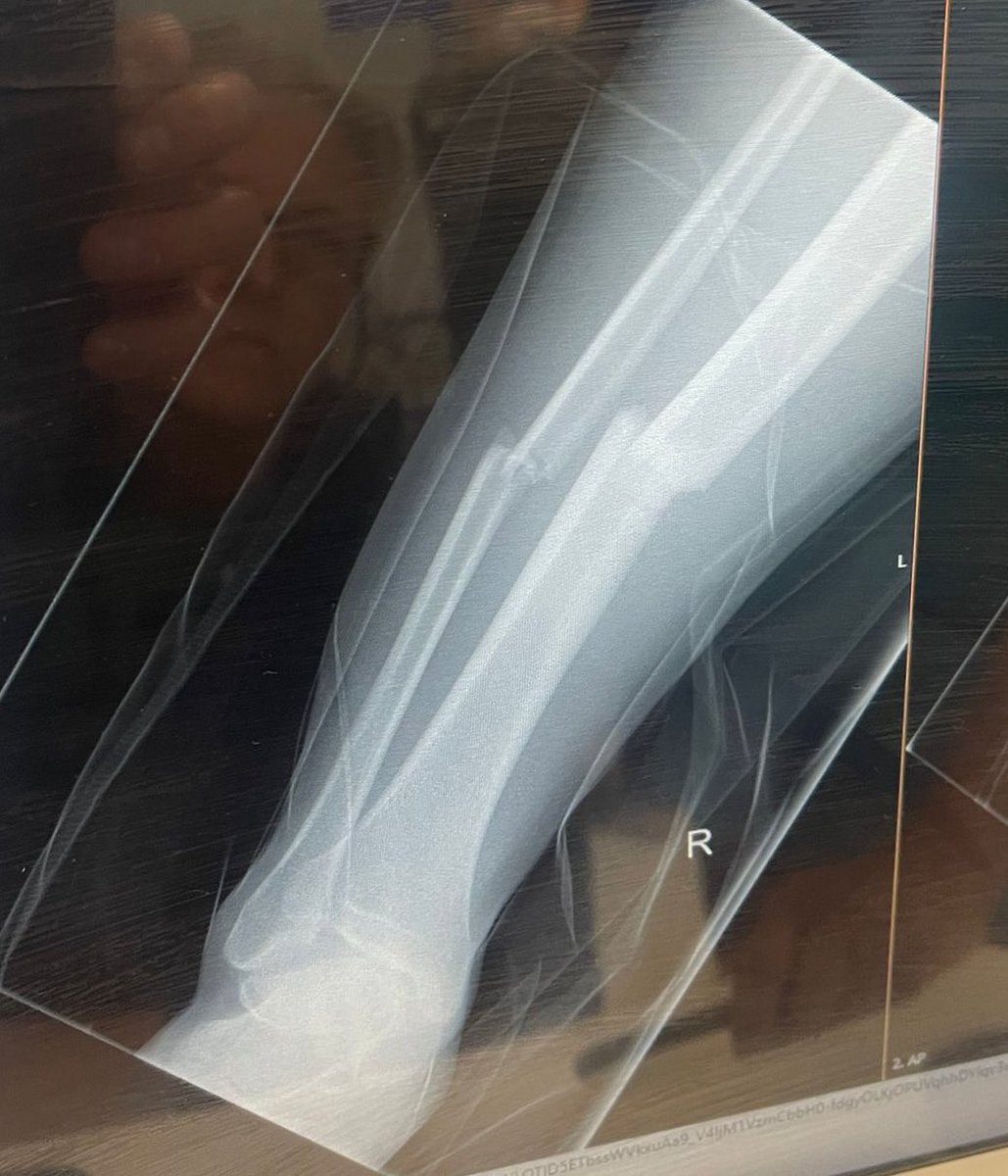 Chaddertonfcjnrs™© tweet media