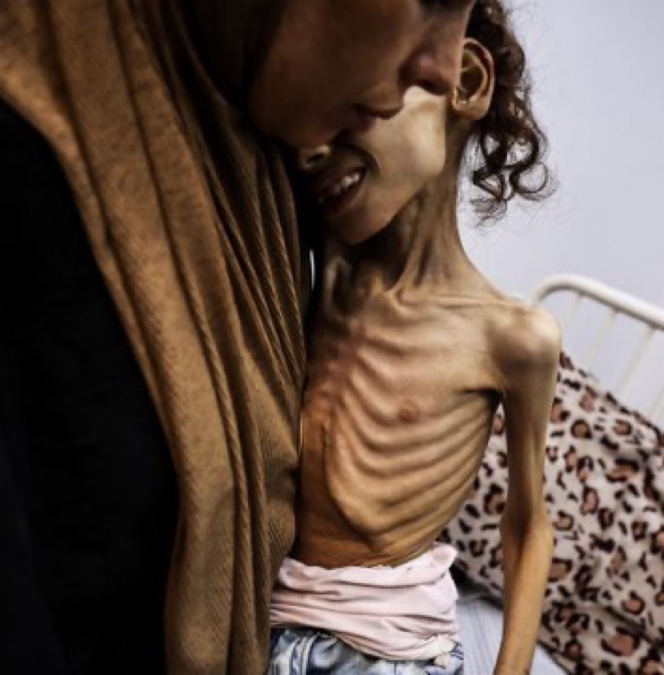 Alee93ale's tweet image. هل تعلم ان الله سيسألنا عن هؤلاء

ماذا سنقول حينها ؟