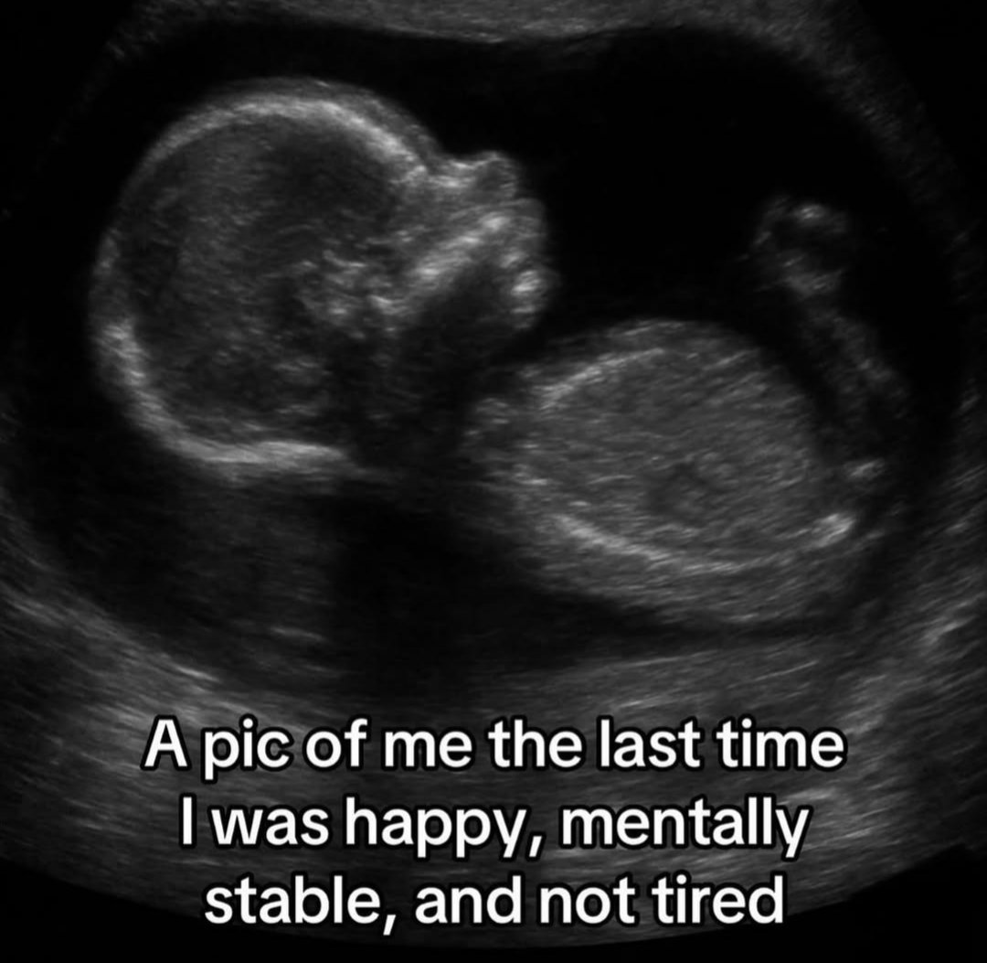 schiz04renic's tweet image. 