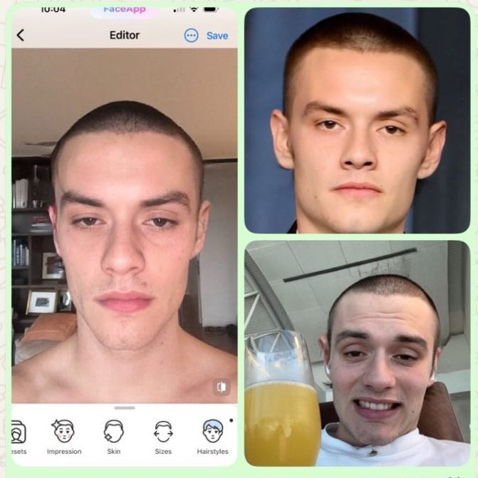 something about millie's love interest costars going bald 😭