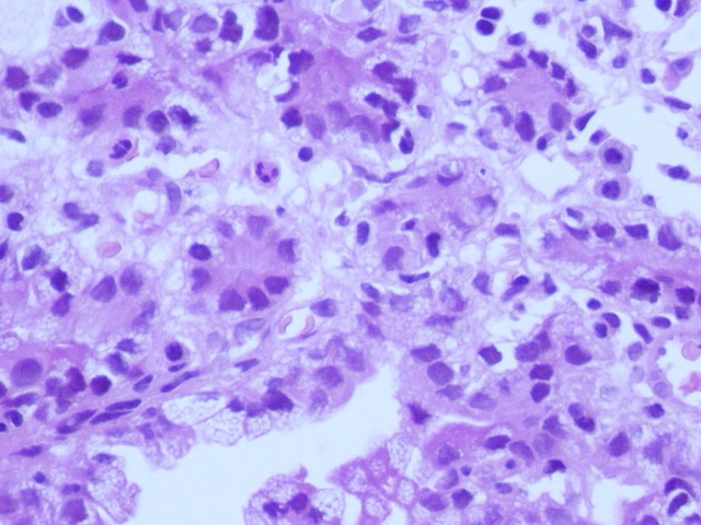 ariella8's tweet photo. 2 / Dear #GUPath #Uropath
a closer look pics https://t.co/FDxAOofzIo