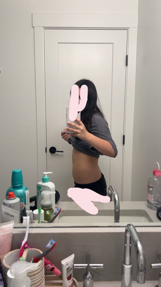 AnaInkDiary's tweet photo. use me as Fatspo💗✌🏽 I am a fat pig🥹 111 pounds #fatspo #ana #ricecakesociety #proana #girlblogger #hateme #fat #obesepig #onikaburgers https://t.co/XDt53flcoW