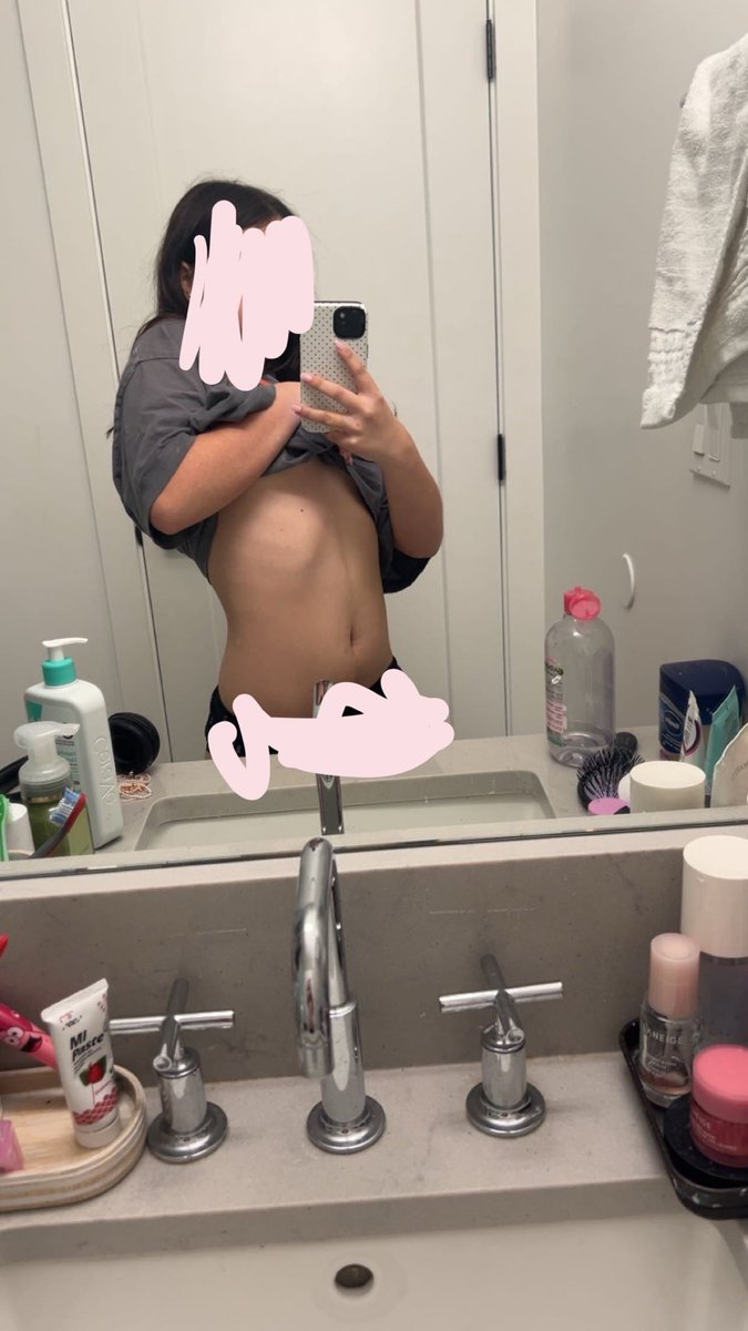 AnaInkDiary's tweet photo. use me as Fatspo💗✌🏽 I am a fat pig🥹 111 pounds #fatspo #ana #ricecakesociety #proana #girlblogger #hateme #fat #obesepig #onikaburgers https://t.co/XDt53flcoW