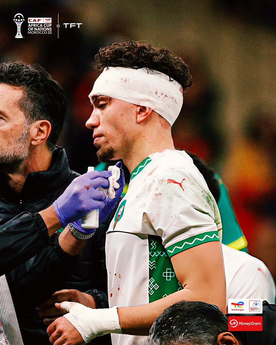 Neil El Aynaoui décide de terminer le match et de se sacrifier ! 

GUERRIER ! ❤️🇲🇦