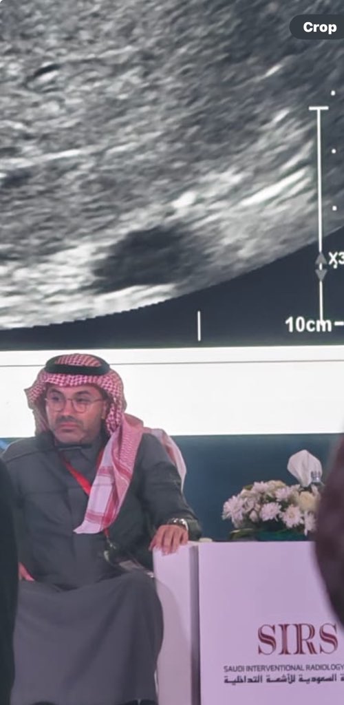 AzizMulhim1's tweet photo. مؤتمر الجمعية السعودية للأشعة التداخلية  "حدث الاسبوع" .. نسخه استثنائية مميزة جدا بمشاركة متحدثين بخبرات علمية عالية وتبادل افكار فالتخصص .. تنظيم رائع جدا .. شكرا لكل من ساهم وحضر .. نراكم فالسنة القادمة بإذن الله✨@sirs_ksa https://t.co/6p6ElZ0JEB