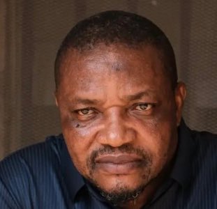 trigottista's tweet image. This Emeka has the same patch on his forehead like you o

Just observing