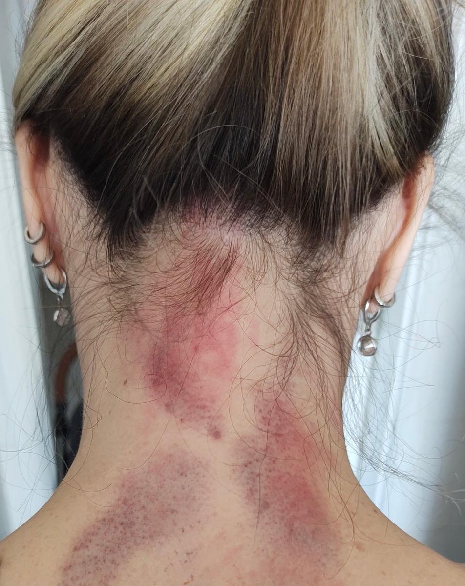 AcPedroa's tweet image. Ainda sobre ontem:
Foi minha primeira experiência com dois machos ao mesmo tempo.
Foi SENSACIONAL.
Bastante intenso.
E violento, muito violento.
Adorei cada minuto, cada estocada, cada gozada.
Sorte que tudo foi muito bem filmado.
Vocês verão.