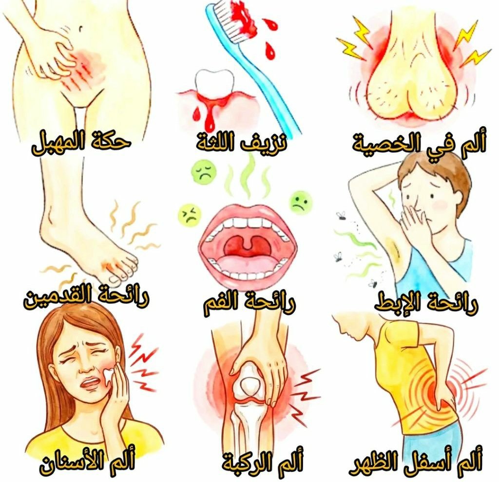 8iff6's tweet photo. أسباب آلام وروائح ومشاكل شائعة وطرق طبيعية للتخلص منها
🔴 ألم الخصية
✅ الأسباب المحتملة
1- الإجهاد البدني أو المجهود الزائد
2- الجلوس لفترات طويلة
3- احتقان مؤقت
4- ارتداء ملابس ضيقة

✅ الطرق الطبيعية للتخفيف منها
1- الراحة وتقليل الحركة الشاقة
2- كمادات دافئة
3- ارتداء ملابس داخلية مريحة
4- شرب الماء بانتظام

🔴 نزيف اللثة
✅ الأسباب المحتملة
1- تنظيف الأسنان بطريقة خاطئة
2- تراكم الجير
3- نقص بعض الفيتامينات
4- إهمال العناية بالفم

✅ الطرق الطبيعية للتخفيف منها
1- تنظيف الأسنان بلطف
2- المضمضة بالماء والملح
3- الإكثار من الخضروات الورقية
4- التقليل من السكريات

🔴 حكة المهبل
✅ الأسباب المحتملة
1- الجفاف
2- الحساسية من بعض المنتجات
3- التعرق الزائد
4- تغيّر التوازن الطبيعي

✅ الطرق الطبيعية للتخفيف منها
1- الحفاظ على النظافة دون إفراط
2- تجنب الصابون المعطر
3- ارتداء ملابس قطنية
4- شرب كمية كافية من الماء

🔴 رائحة الإبط
✅ الأسباب المحتملة
1- التعرق الزائد
2- البكتيريا
3- عدم تجفيف الإبط جيدًا
4- بعض العادات الغذائية

✅ الطرق الطبيعية للتخفيف منها
1- الاستحمام المنتظم
2- تجفيف ��لإبط جيدًا
3- استخدام مواد طبيعية مثل ماء الورد
4- تقليل الأطعمة الحارة

🔴 رائحة الفم
✅ الأسباب المحتملة
1- جفاف الفم
2- بقايا الطعام
3- إهمال تنظيف اللسان
4- قلة شرب الماء

✅ الطرق الطبيعية للتخفيف منها
1- شرب الماء باستمرار
2- تنظيف اللسان
3- المضمضة بالماء والملح
4- مضغ النعناع أو القرنفل

🔴 رائحة القدمين
✅ الأسباب المحتملة
1- التعرق
2- الرطوبة المستمرة
3- الأحذية المغلقة لفترات طويلة
4- عدم تغيير الجوارب

✅ الطرق الطبيعية للتخفيف منها
1- غسل القدمين يوميًا
2- تجفيف القدمين جيدًا
3- تغيير الجوارب بانتظام
4- تهوية الأحذية

🔴 ألم أسفل الظهر
✅ الأسباب المحتملة
1- الجلوس بوضعية خاطئة
2- قلة الحركة
3- إجهاد العضلات
4- حمل أوزان ثقيلة

✅ الطرق الطبيعية للتخفيف منها
1- تمارين التمدد الخفيفة
2- تحسين وضعية الجلوس
3- كمادات دافئة
4- المشي المنتظم

🔴 ألم الركبة
✅ الأسباب المحتملة
1- ضعف العضلات
2- زيادة الوزن
3- إجهاد المفصل
4- قلة الحركة

✅ الطرق الطبيعية للتخفيف منها
1- تقوية عضلات الفخذ
2- تقليل الضغط على الركبة
3- كمادات دافئة أو باردة
4- الحركة المعتدلة

🔴 ألم الأسنان
✅ الأسباب المحتملة
1- التسوس
2- الحساسية
3- تراكم بقايا الطعام
4- مضغ أطعمة قاسية

✅ الطرق الطبيعية للتخفيف منها
1- المضمضة بالماء والملح
2- تنظيف الأسنان بانتظام
3- تجنب السكريات
4- استخدام فرشاة ناعمة
اذا اتممتت القراءة صل على سيدنا محمد