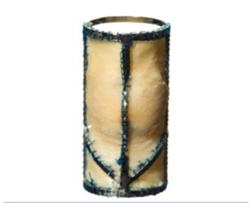 JVS - Venous and Lymphatic Disorders tweet media