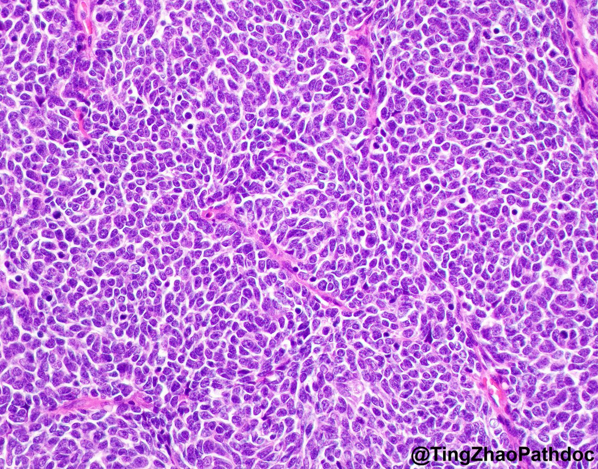 Ting Zhao, MD tweet media