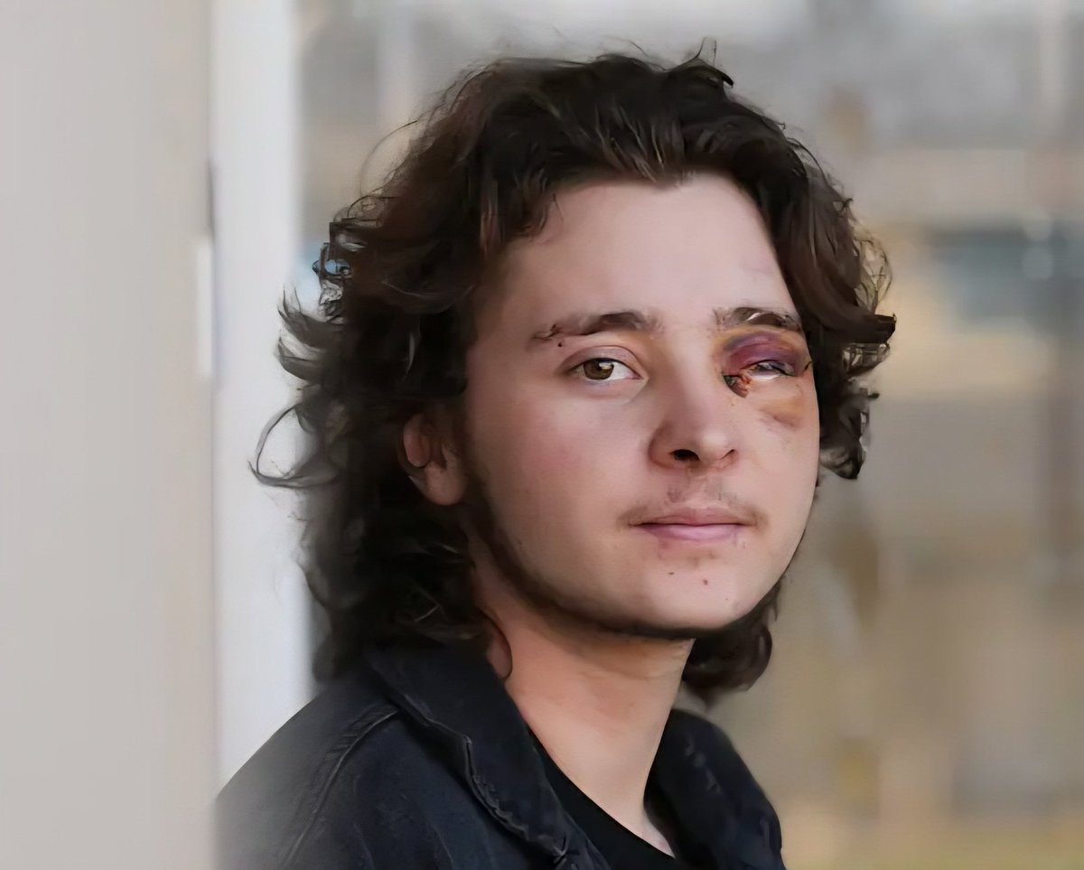 AlBuffalo2nite's tweet image. You mean to tell me that this dude was a woman the entire time while masquerading in testosterone?? 

Their birth name is Kelsey?

More…. Violent Protestors? 

Come one American News outlets! 

Do better.