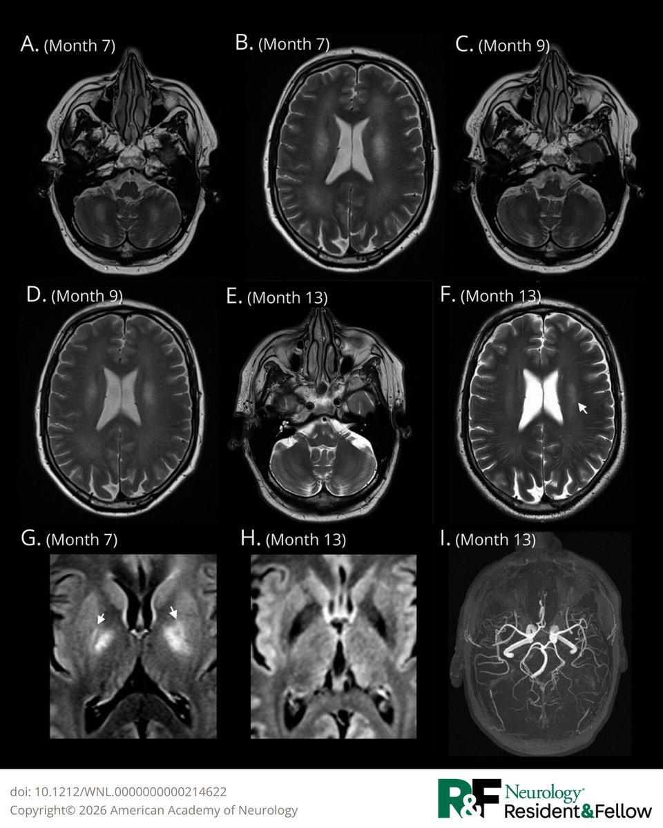 Neurology Journal tweet media