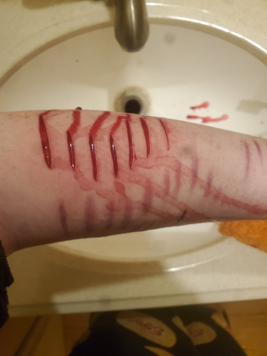 59_SINNER's tweet photo. I'm so happy😐 look at my fat ass arm #shtwt #selfharm #sh https://t.co/CuYIalpDgv
