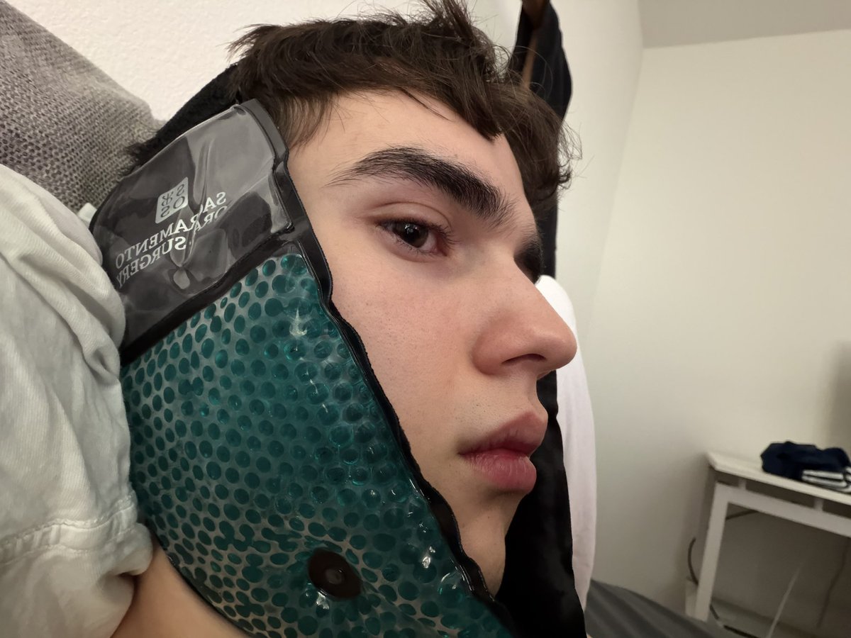 _swingpool_'s tweet image. do NOT wait till you’re 23 to get your wisdom teeth pulled 💔