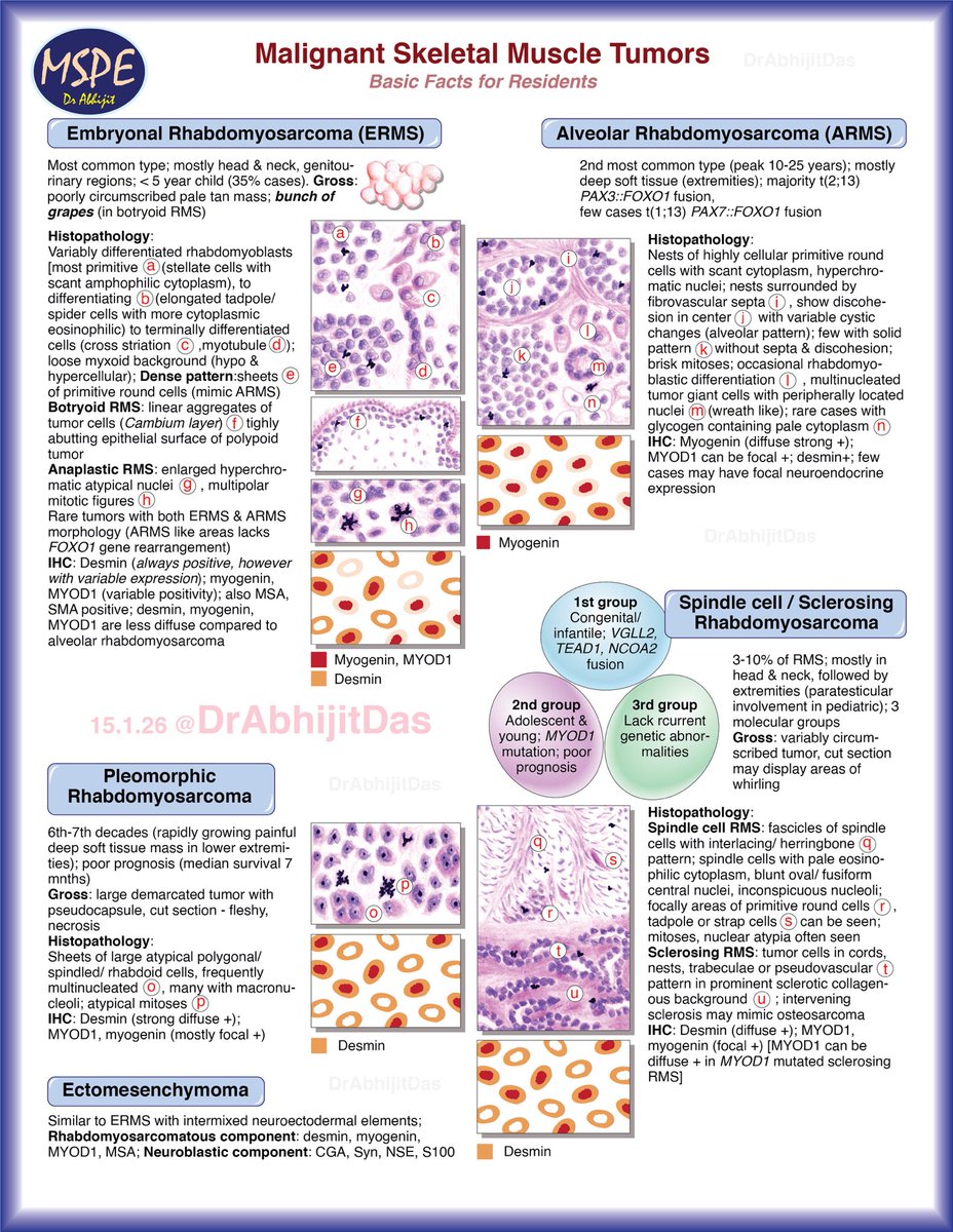 AbhijitSurgPath's tweet image. Skeletal muscle tumors - malignant (basic facts for residents)
