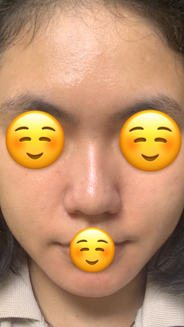 ✨OMBB | 🚫NO LINK tweet media