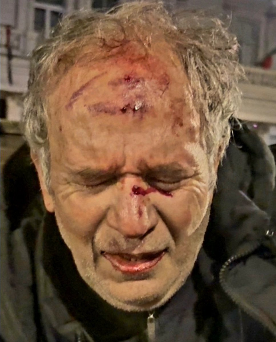 EvacTony's tweet photo. I don’t know everything about this protest at Westminster but I would say this, in all the years of the Palestine marches all over the country which intimidated Jews and were often openly antisemitic, have you ever seen the police do this? 

Have you seen any pro Palestine protesters beaten and bloodied like this? I haven't, I saw them climb all over war memorials and poppies and just politely asked to get down. 

#FreeIran #Iran #Westminster #London