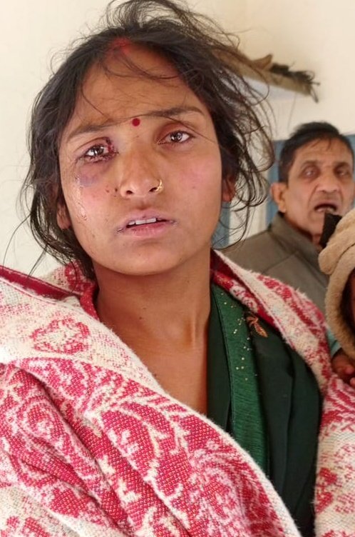 श्रीमान <a href="/chitrakootpol/">Chitrakoot Police</a> कृपया मामले को संज्ञान लीजिए और पीड़ित को न्याय में मदद कीजिए क्योंकि पीड़िता का कहना है ससुराल वाले जान से मारने की धमकी भी दे रहे है! मामला रैपुरा थाना अंतर्गत रामनगर ग्राम पंचायत का है!!
<a href="/Uppolice/">UP POLICE</a> <a href="/ADGZonPrayagraj/">ADG Zone Prayagraj</a> <a href="/rangechitrakoot/">DIG Range Chitrakoot</a> <a href="/dgpup/">DGP UP</a>