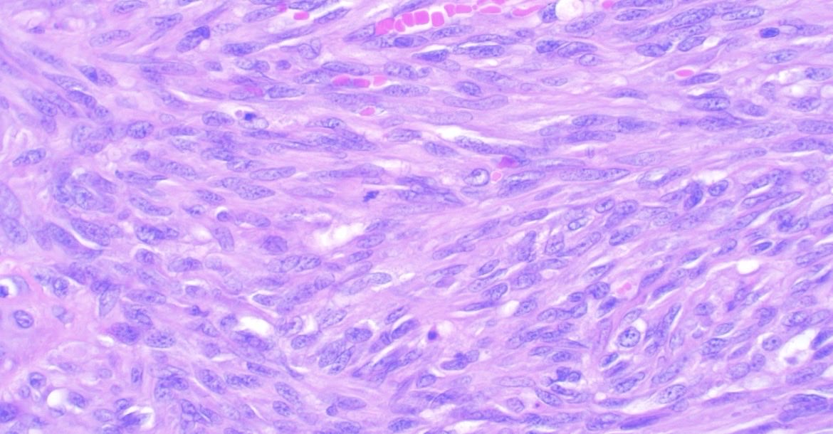 Jose Candido tweet media