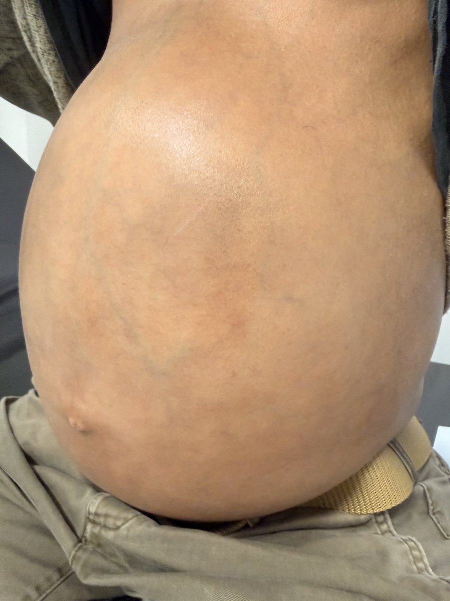 Keith Siau tweet media