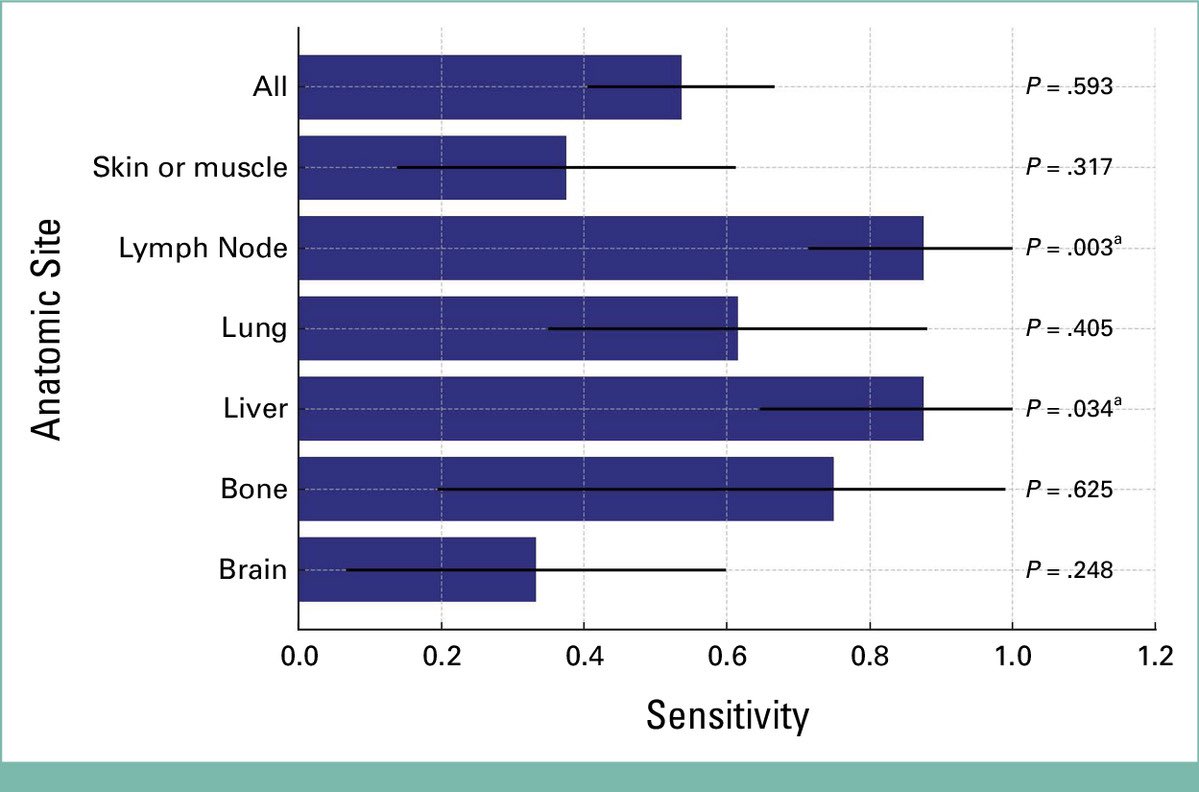 MarioBalsaMD's tweet photo. 🧬 Sensitivity of circulating tumor DNA for detection of MRD recurrence in melanoma (56 pt, stage II to IV) @JCO_ASCO 
https://t.co/YyFEdfdzZZ

🎯 Overall sensitivity 53.6%
💥 Strongly site-dependent: highest in LN (87.5%, P = .003) and liver (87.5%, P = .034), lowest in brain (33.3%, P = .248)

Minimal disease, maximal nuance. Sensitivity is contextual 🧠 

@OncoAlert #OncoAlertAF @OncoReporte @myESMO @_SEOM @ASCO