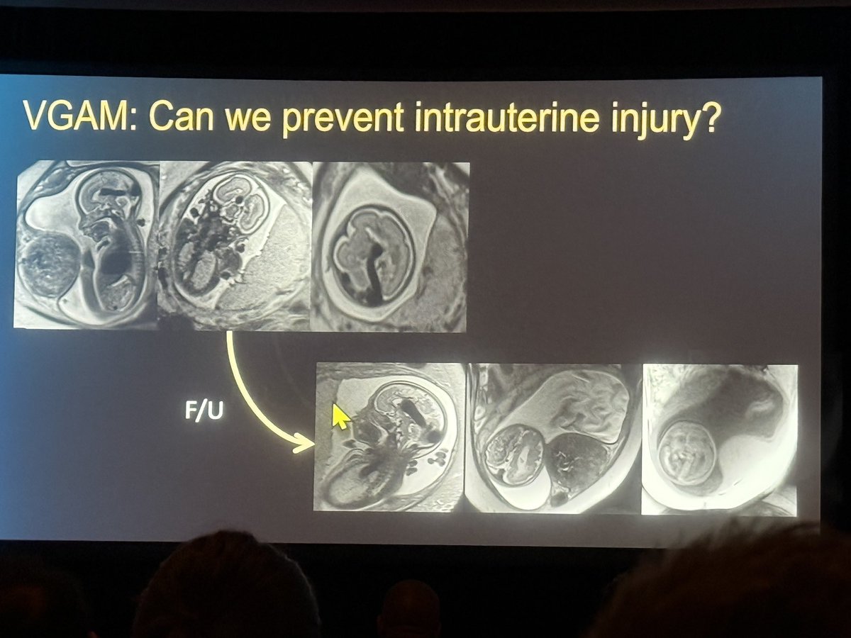 American Society of Pediatric Neuroradiology tweet media