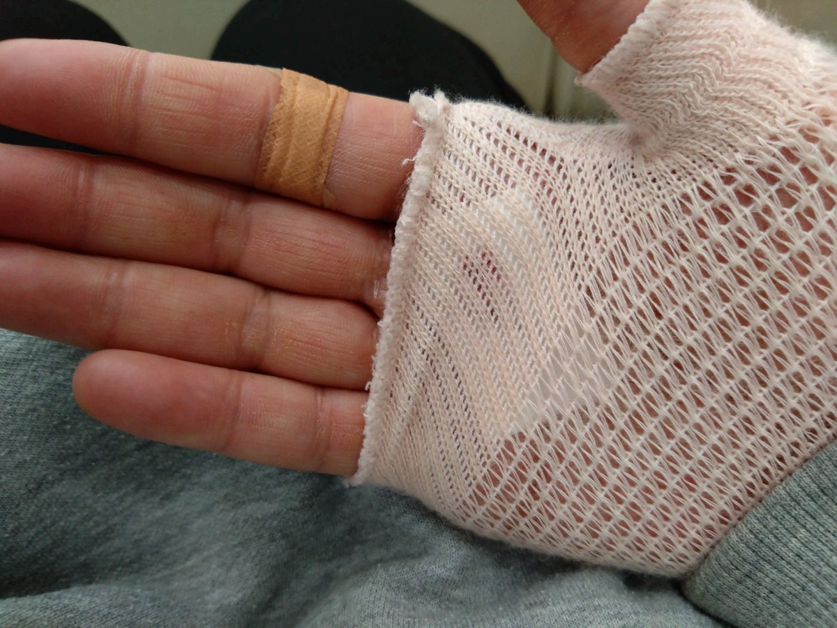 手のひらガッツリ噛まれて何も出来ないので、義母はショートステイに行きました。