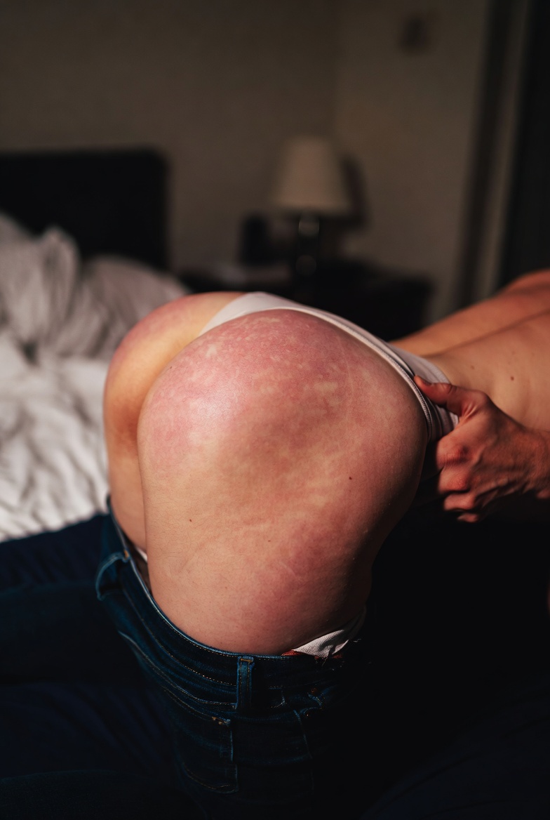 最近老是幻想一种更极端的日常——不是偶尔，而是几乎每晚都要被他按在膝盖上，脱掉裤子，狠狠地打屁股。不是轻拍，是那种一下下实打实的巴掌，力道越来越重，直到我忍不住哭出来还得咬牙忍着，一声不许求饶。打到屁股彻底肿起来，红紫交错，坐都坐不了，第二天还能感觉到火辣辣的疼和鼓起的痕迹。那种疼