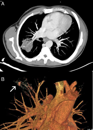 La Revue de Médecine Interne tweet media