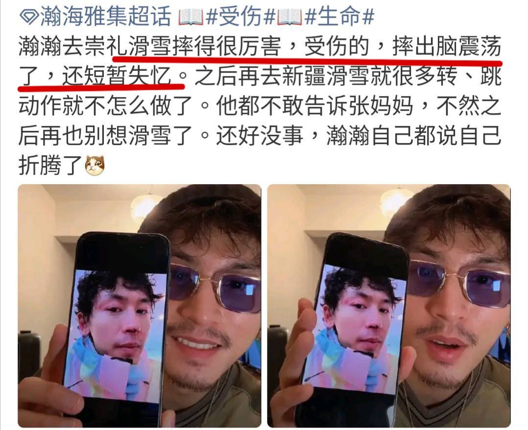 Jian said in his livestream today that he previously had a temporary amnesia, because he hit his head when skiing...🤣