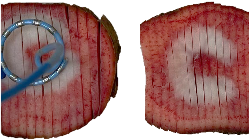 William H. Sauer, MD tweet media