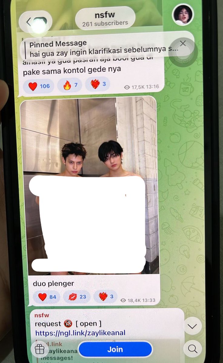 protectkeonho's tweet photo. 🚨🚨🚨 (1/2)  

‼️Do not interact, just report.
‼️Editing K3ONH0 p0rn0gr4phy, nud1ty

🔗https://t.co/2mSPjuNDal https://t.co/lbzKR9BNWN