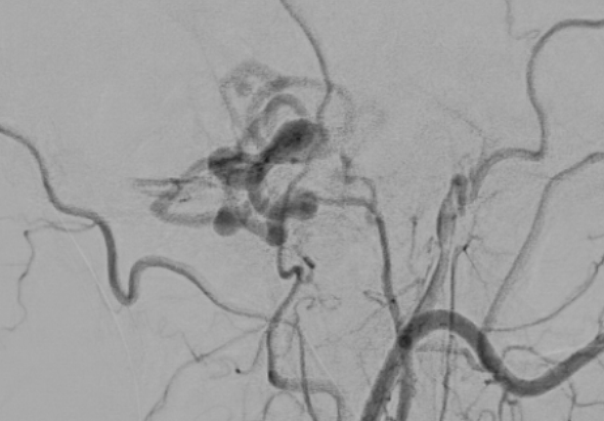 Jack Garnham tweet media