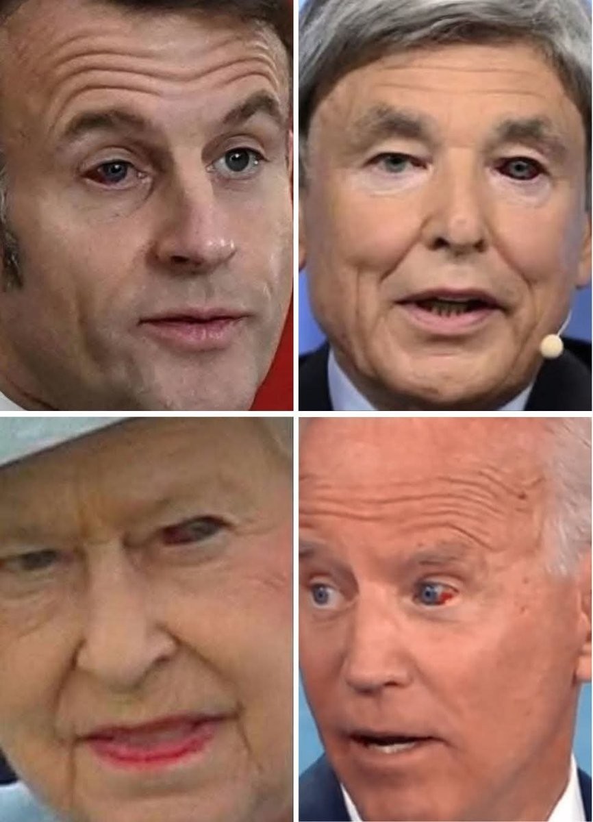 Black Eyes Club : Certaines théories suggèrent qu'une célébrité avec un œil au beurre noir prouve son appartenance à une société secrète comme les Illuminati, parfois en lien avec des rituels, ou le fait d'avoir vendu son âme.

Mais ce n'est qu'une théorie du complot. 🤫