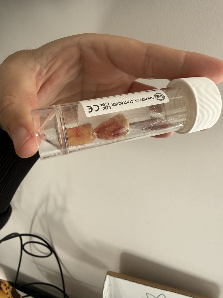 Finally had the wisdom teeth removed the other day. Feeling a little bruised but I’m healing up well 🦷