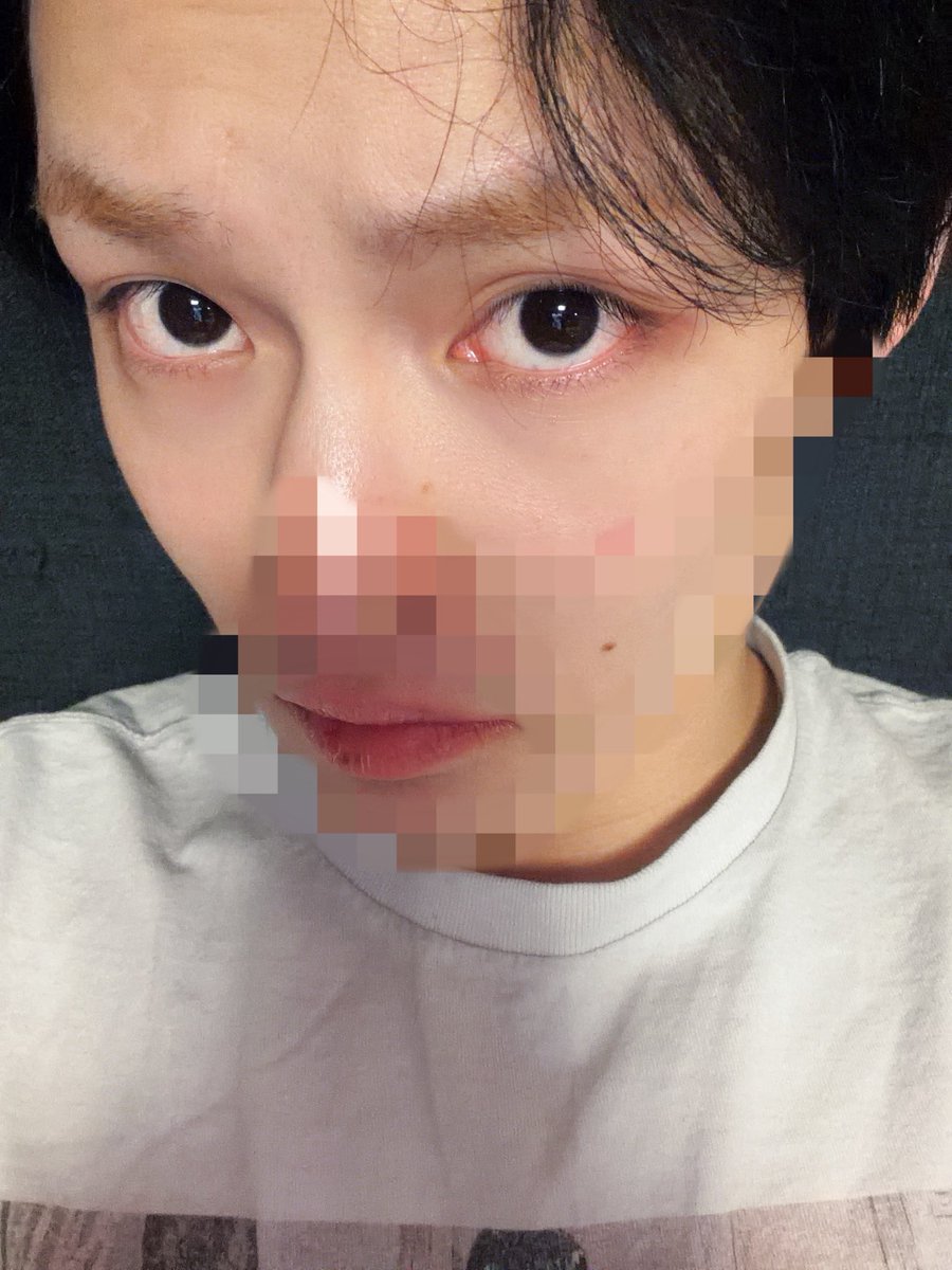 dprleleya's tweet image. Chenle, to be honest with you, your stubbles nor the pores on your nose are the problem; it’s your dry ass lips 😭