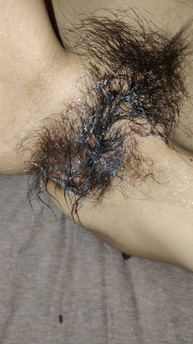 武汉大炮 tweet media