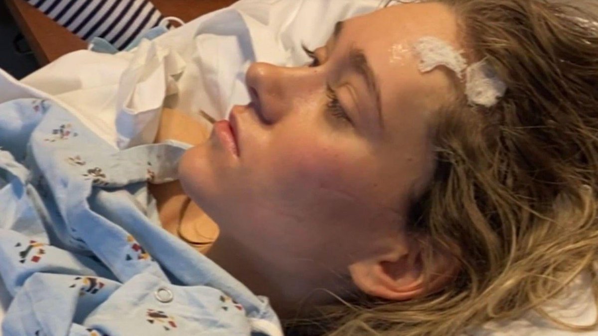 Kadeesayong's tweet image. ข่าวนี้โคตรน่ากลัวเลย ผู้หญิงคนนึงป่วยเรื้อรังหลายเดือนน้ำหลักลดฮวบ 20 โลคิดว่าตัวเองเป็นมะเร็งกระเพาะอาหาร จนวันนึงไม่ไหวไปรพแต่ยังไม่ถึงเตียงก็ชักหมดสติ หมอพบปริมาณตะกั่วจำนวนมากในร่างกาย โดยเฉพาะลำไส้เต็มไปด้วยตะกั่วเกือบ 100%
 
- ก่อนหน้านี้แข็งแรงดีแต่ 6…