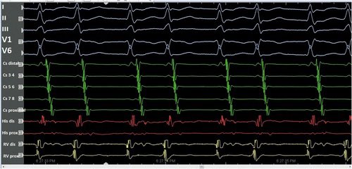 色々自粛中復活🌟 tweet media